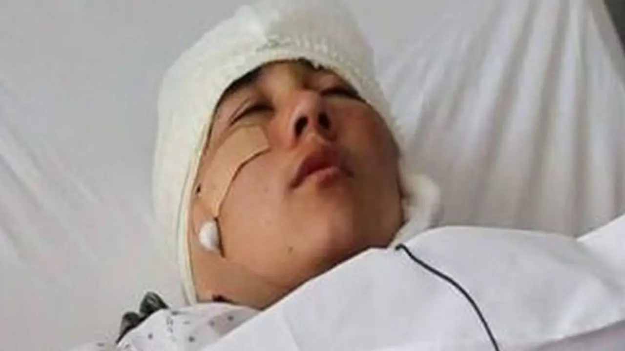 Le cortaron las orejas