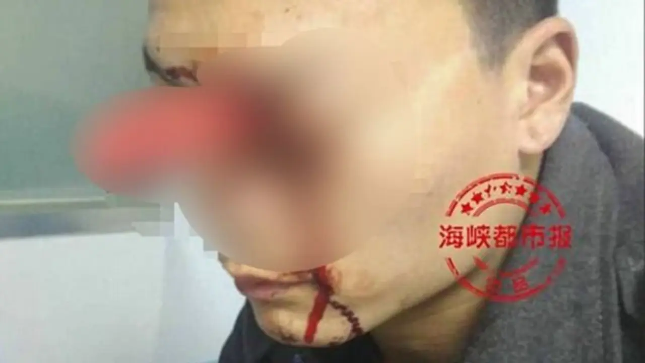 3E38C0AA00000578-0-image-a-18_14894053340161-1024x576