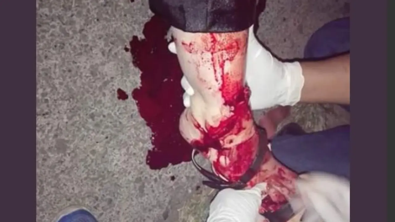 Herida en Santa Tecla