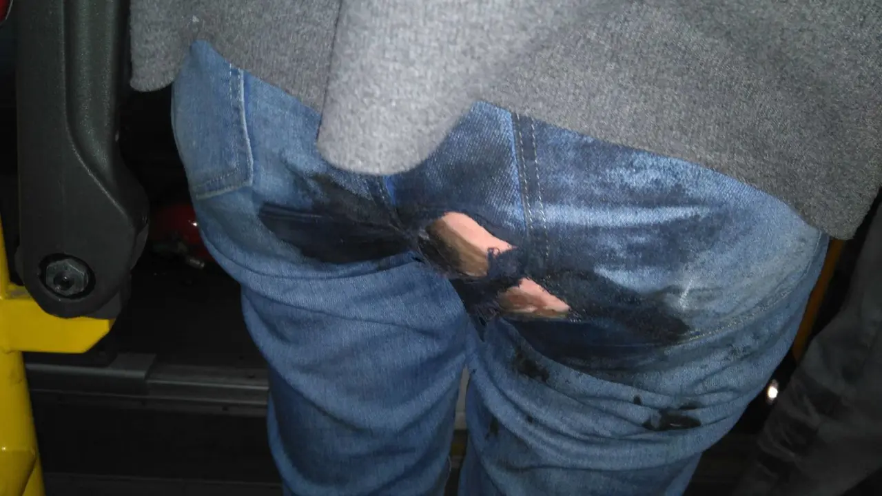 J&oacute;venes quemados