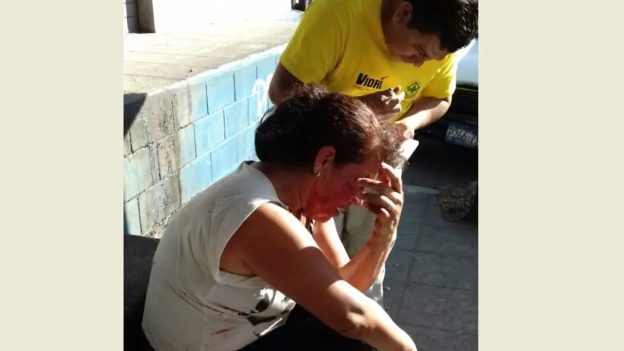 Golpeada copn envase