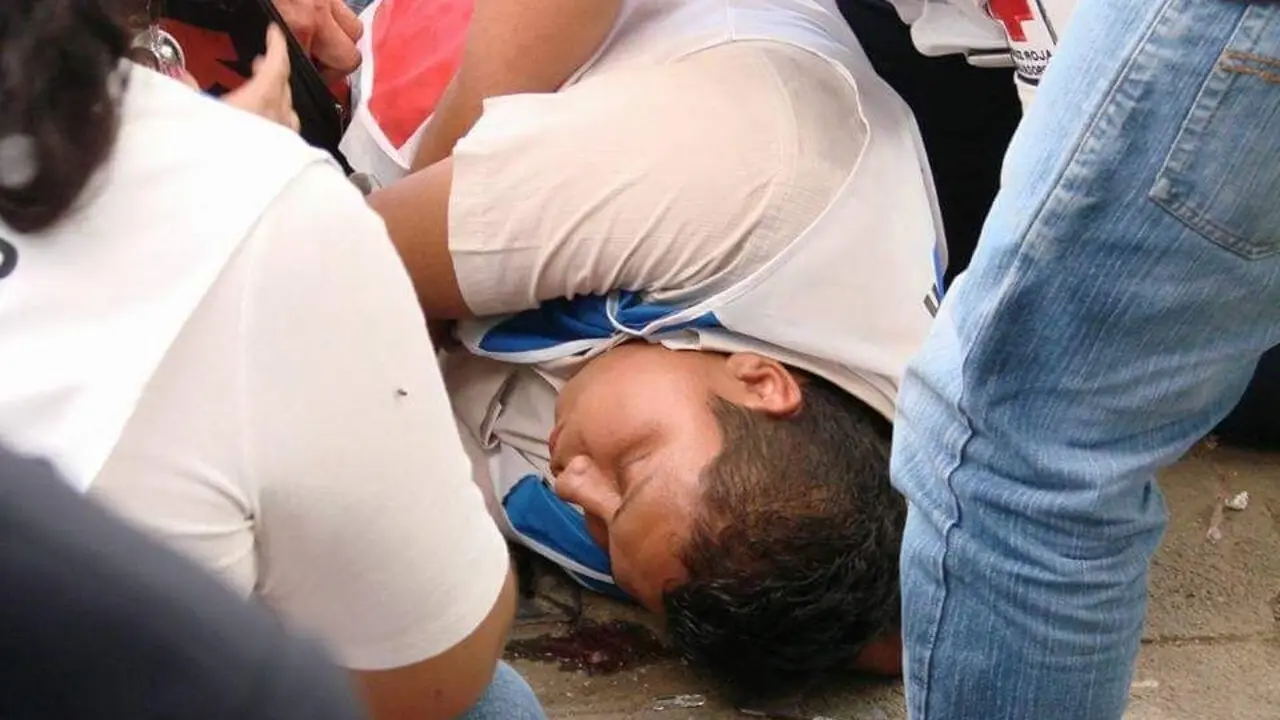 Atienden a paciente por epilepsia en Santa Ana