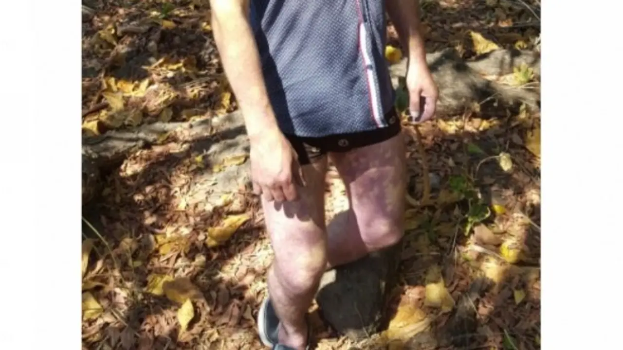 Ahorcado Conchal&iacute;o