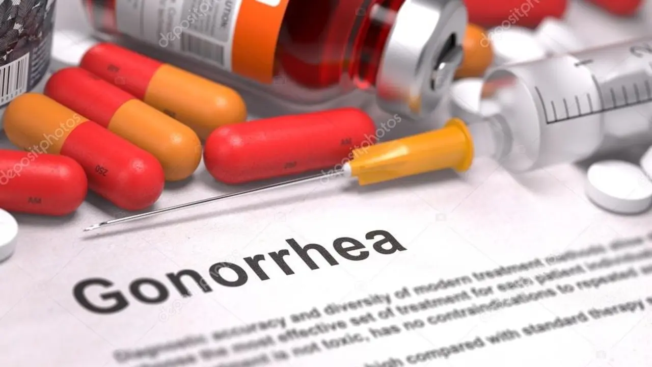 Gonorrea