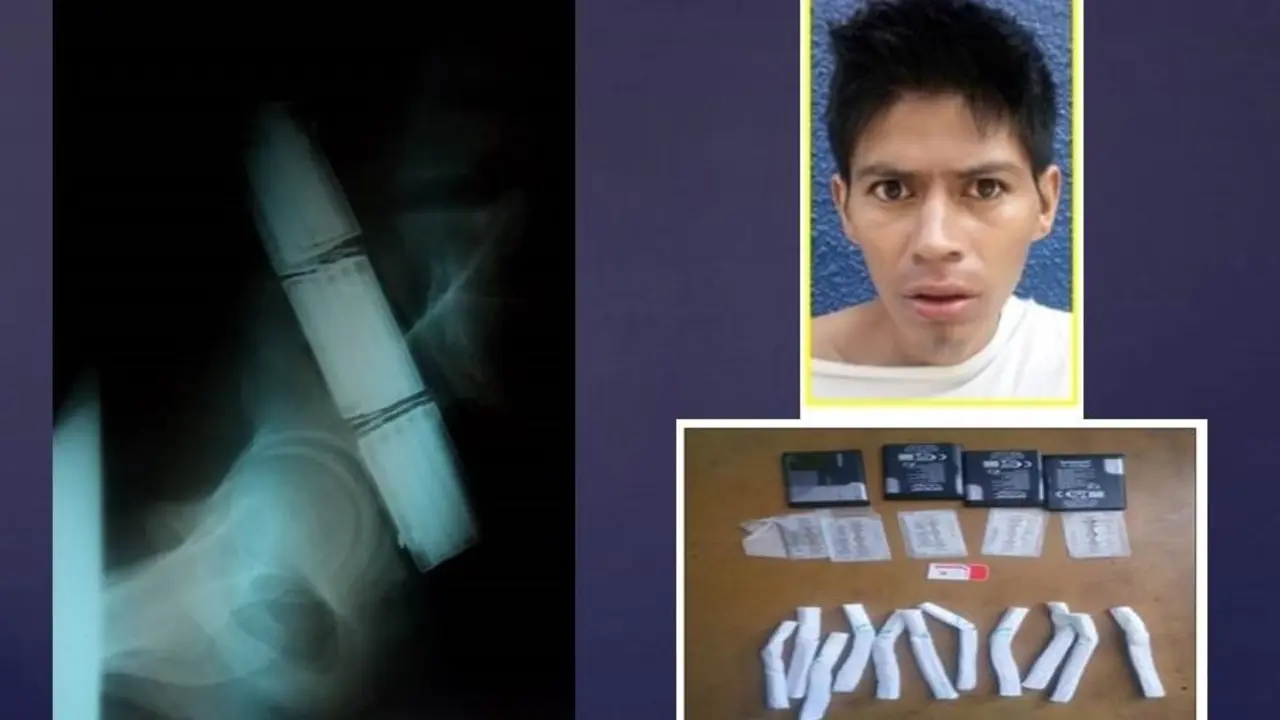 pandillero en mejicanos muere 18R