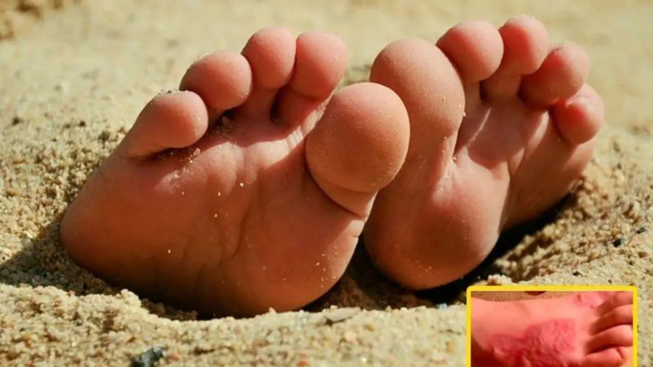 Noticia-211440-playa-ataque