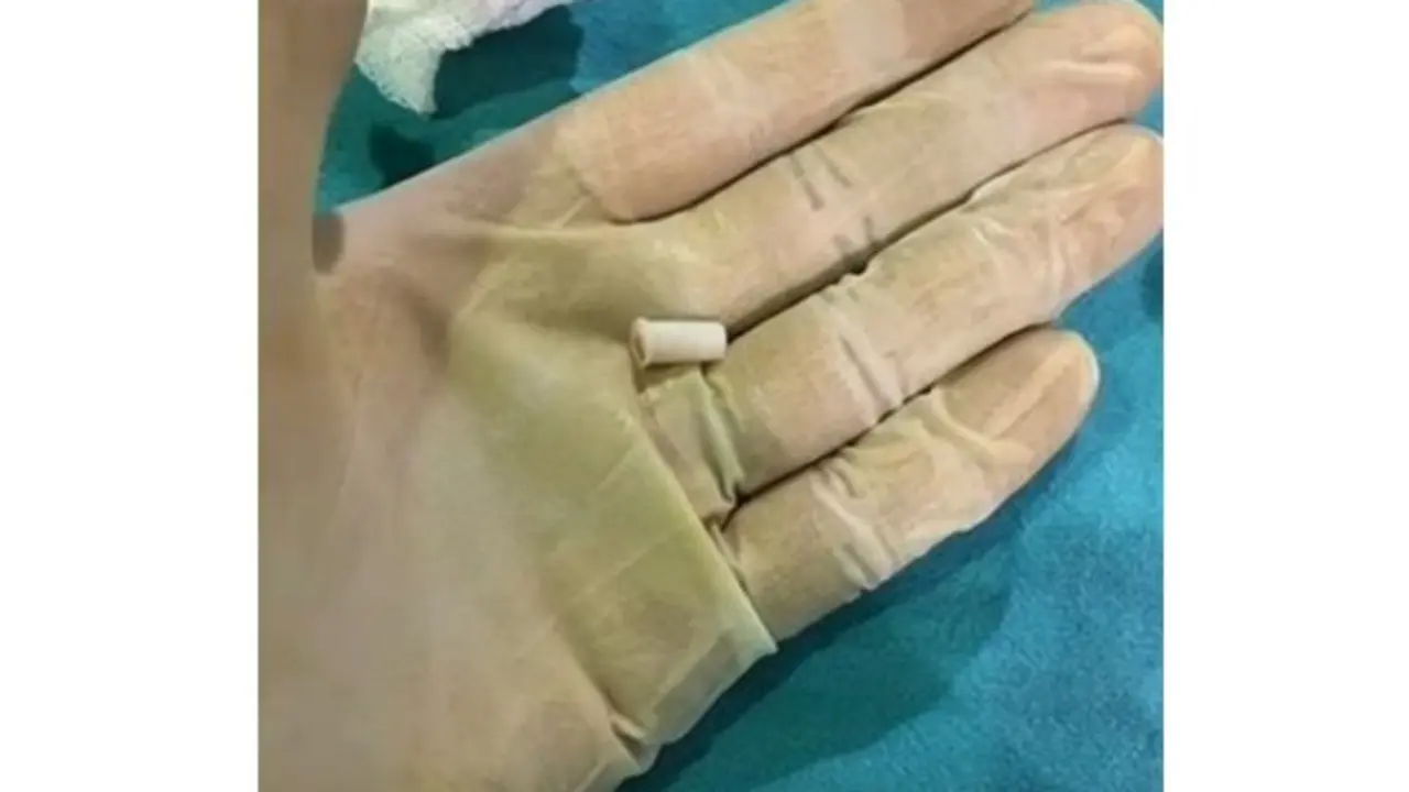 Imagen de referencia tomada de Notim&eacute;rica