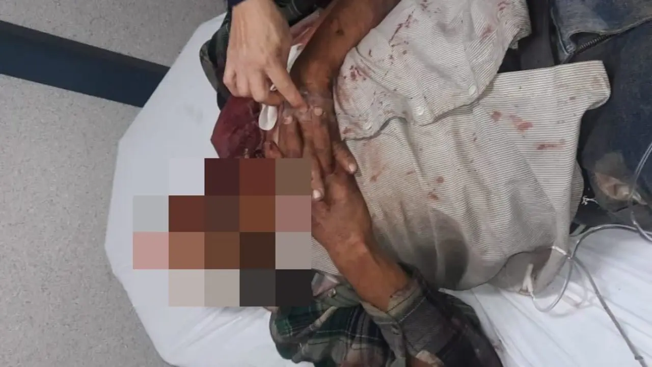 salvadore&ntilde;o golpeado