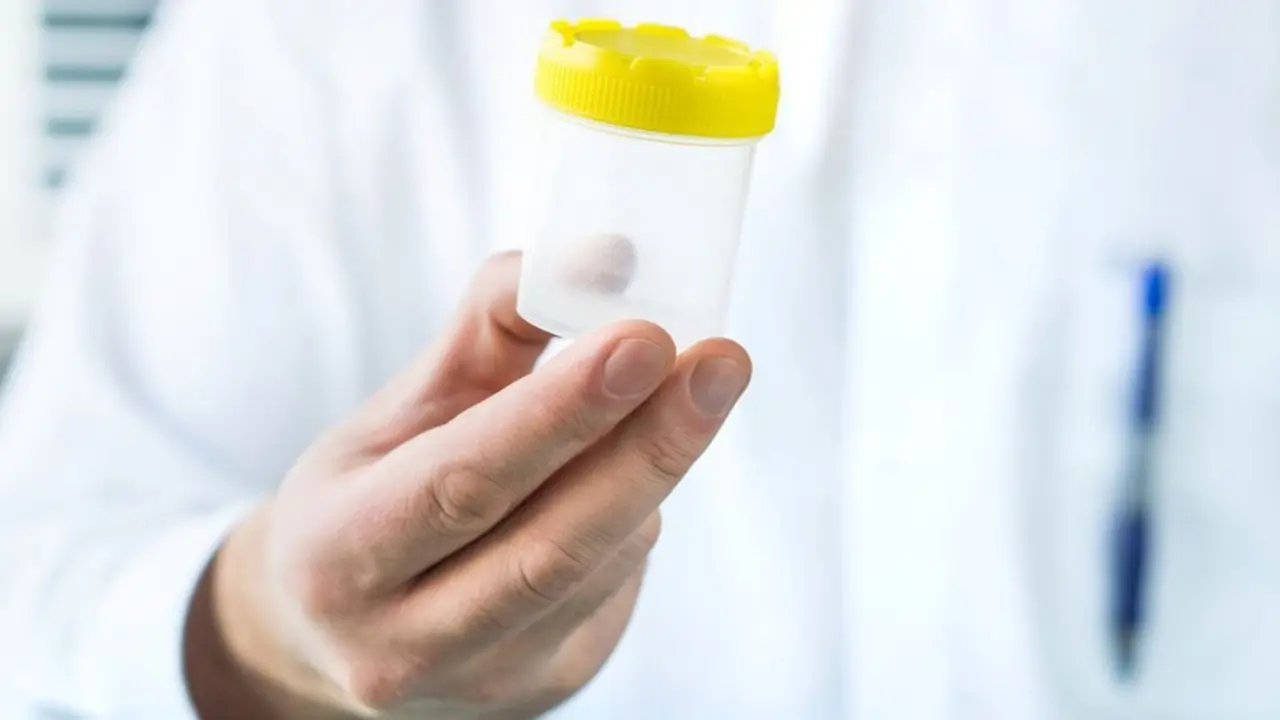 Imagen de referencia tomada de T13