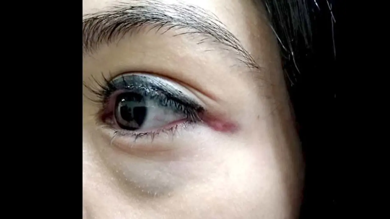 M&eacute;dico agredida