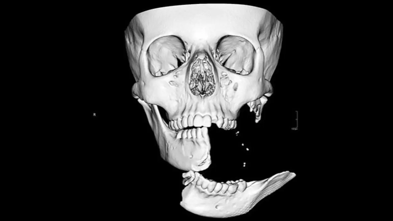 Rostro de adolescente