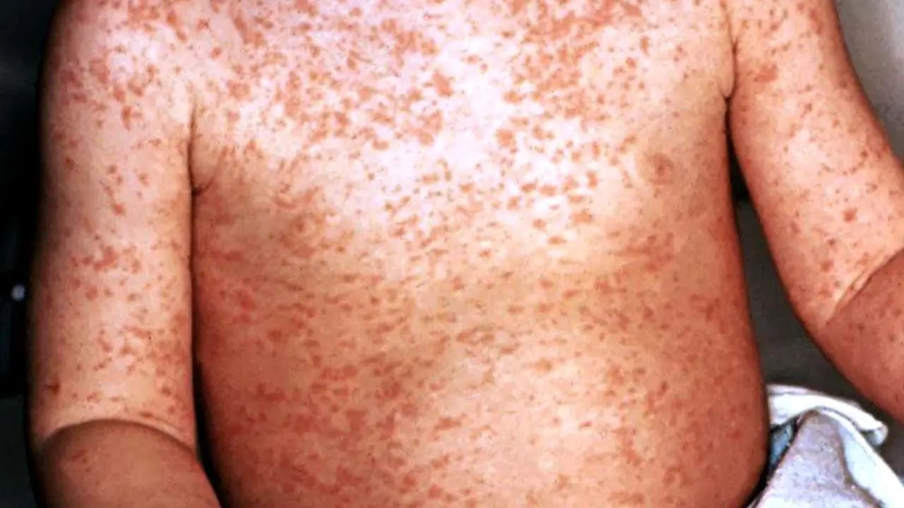 Direcci&oacute;n de vigilancia sanitaria 3