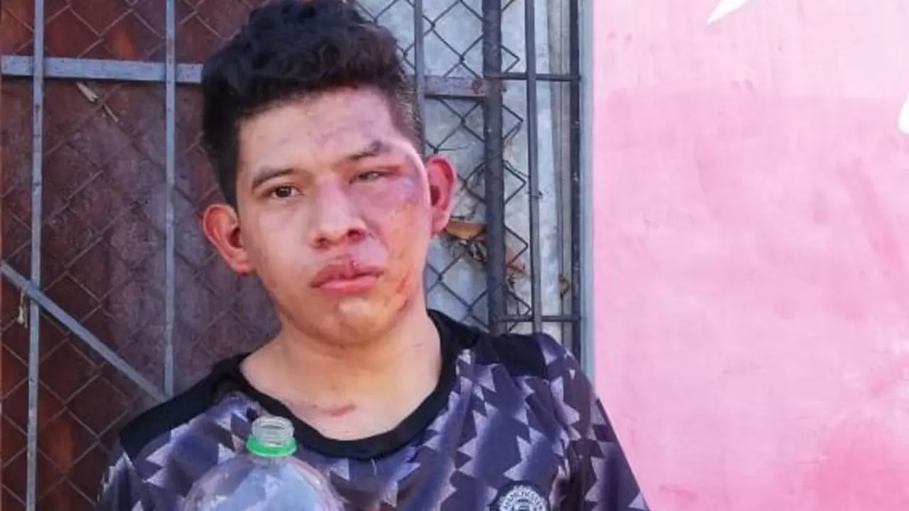 Ladr&oacute;n golpeado en Ciudad Delgado