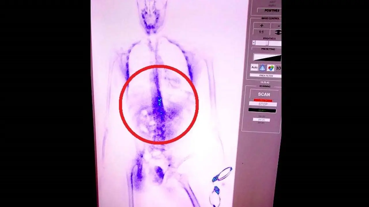 Rayos X detectan mensajes