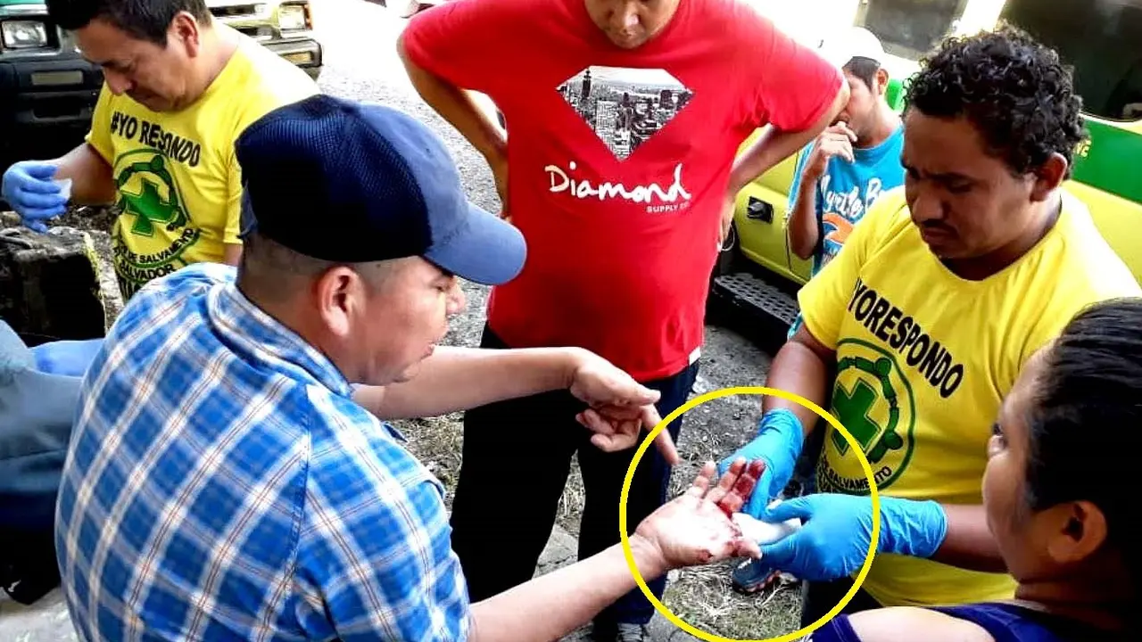 Na&uacute;n C&aacute;rcamo atacado por un perro chow chow en Ciudad Delgado 2