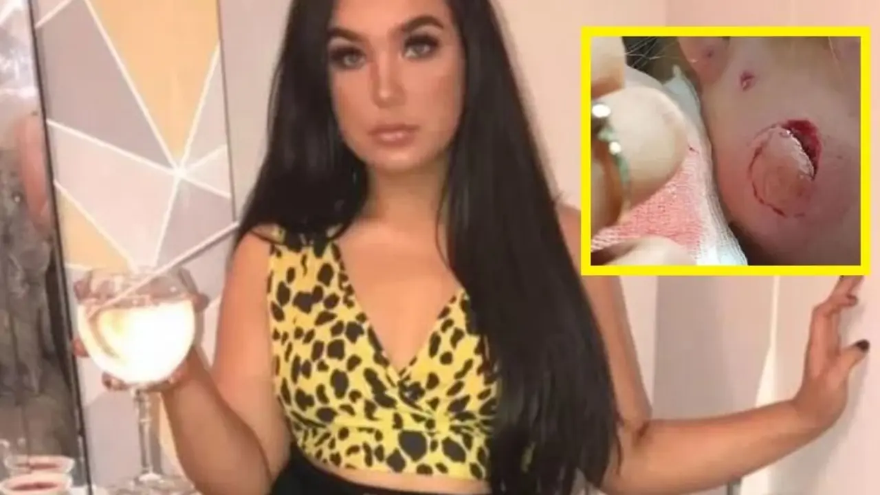 A mordidas a su amiga