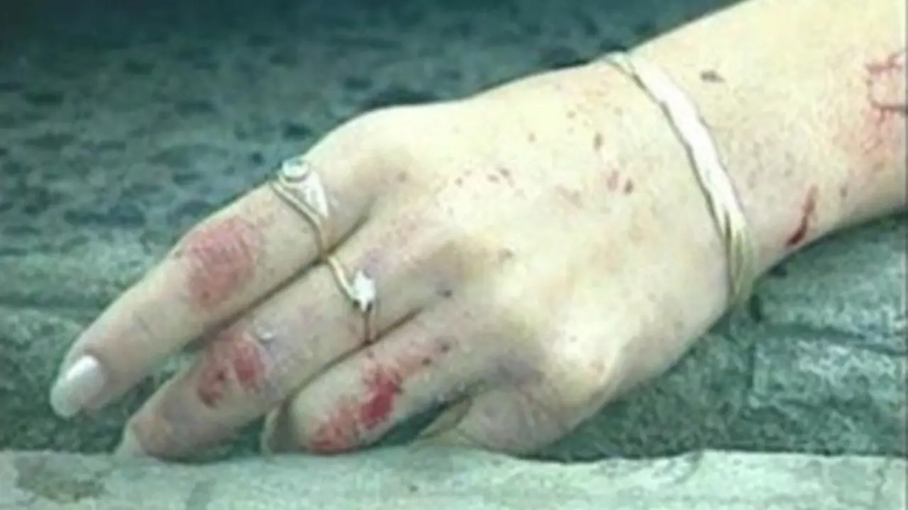 Mano de mujer asesinada