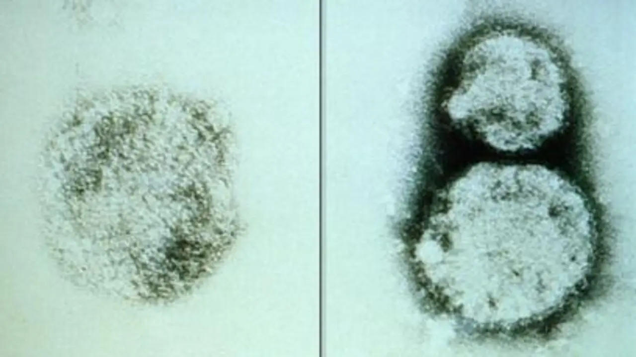 imagen de hantavirus