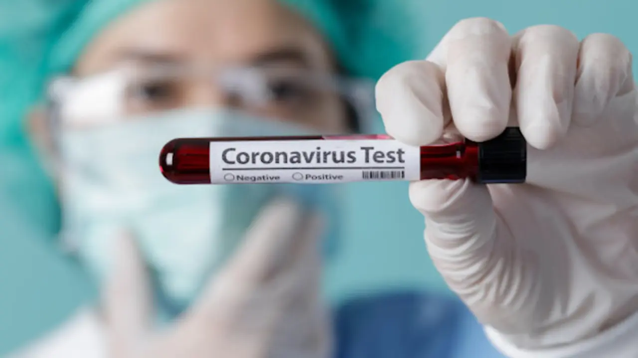 Prueba laboratorio COVID 19