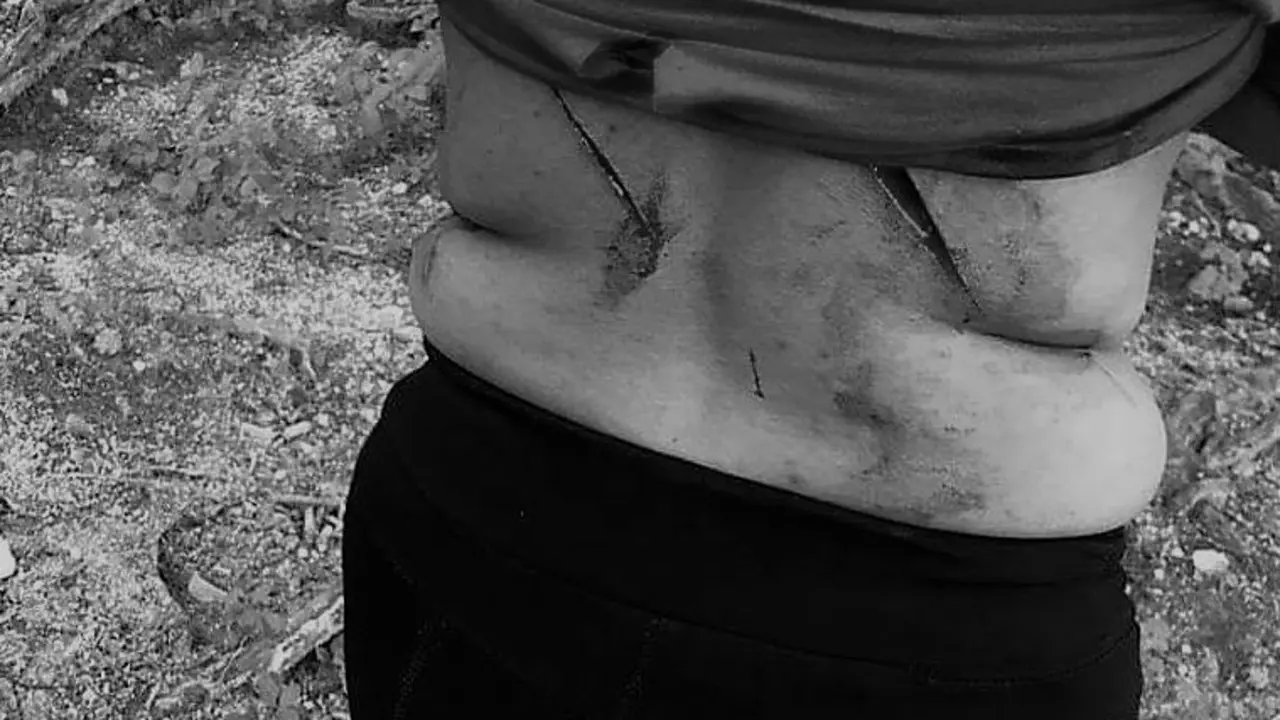 Mujer atacada a Machetazos en La Paz