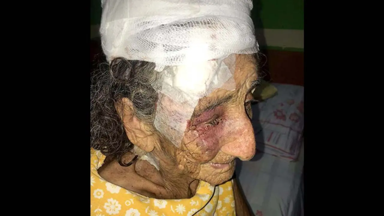 Anciana en Sonsonate es atacada por un pitbull 3