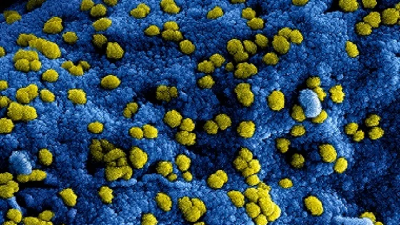 microscopic-shot-of-a-virus-3992937