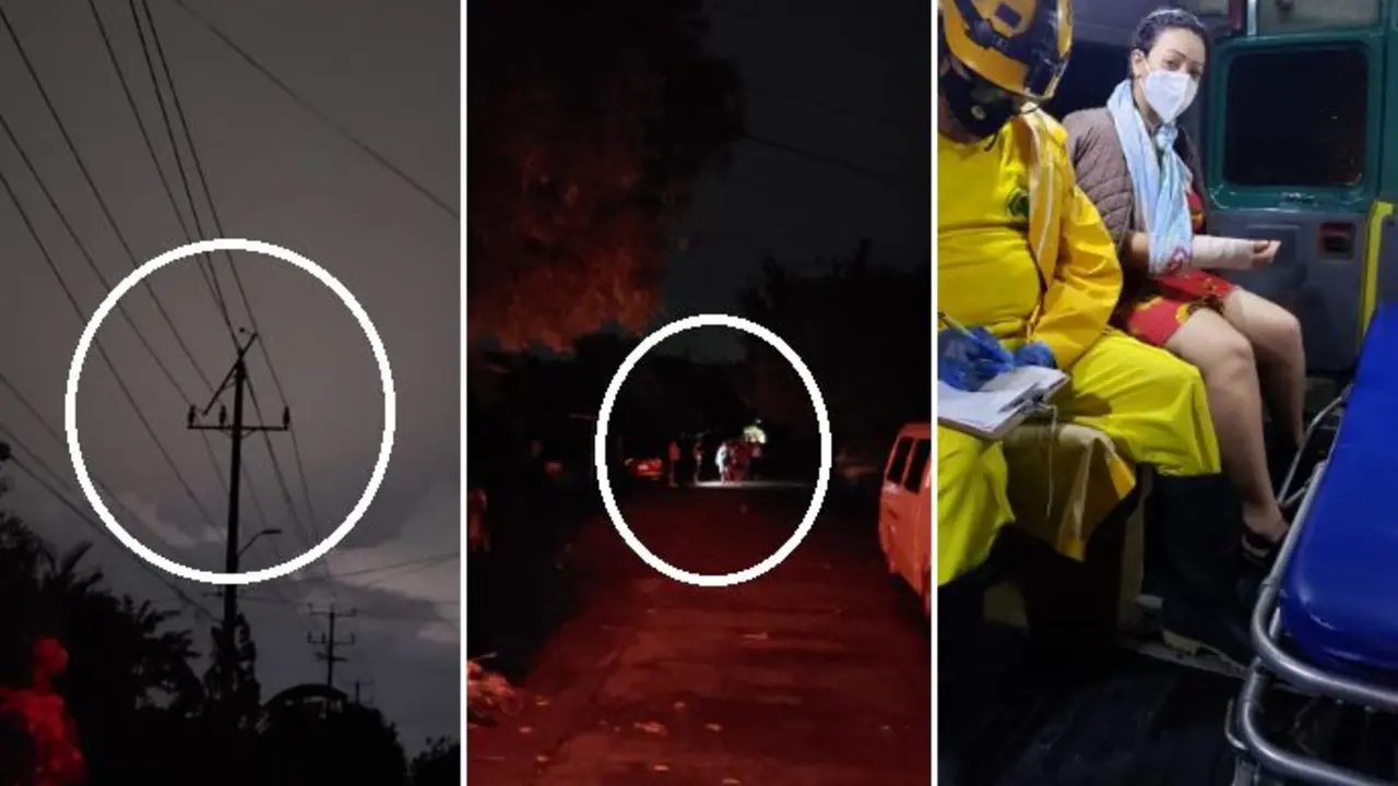 Mujer quemada en Ilopango