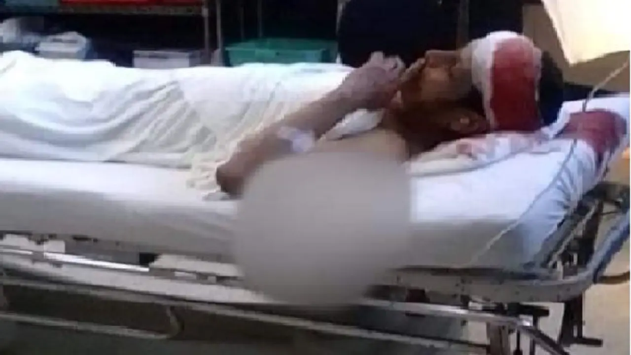 Pandillero atropellado