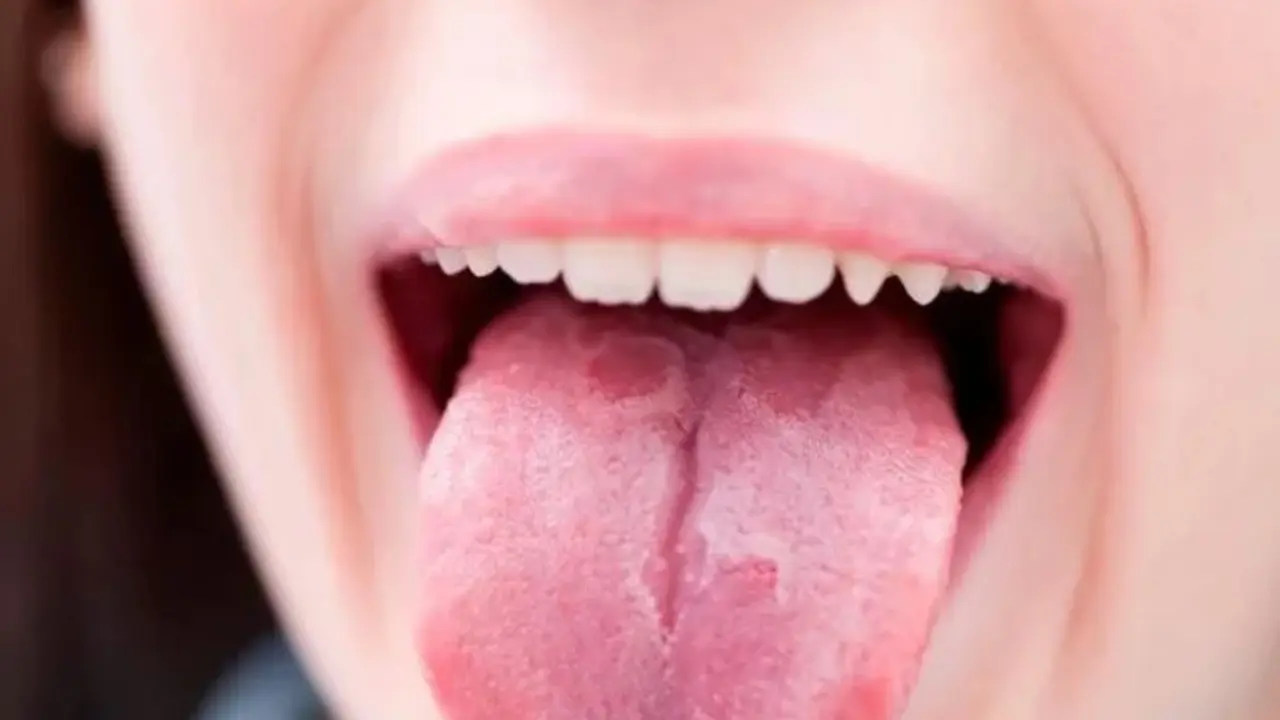 Covid en la boca