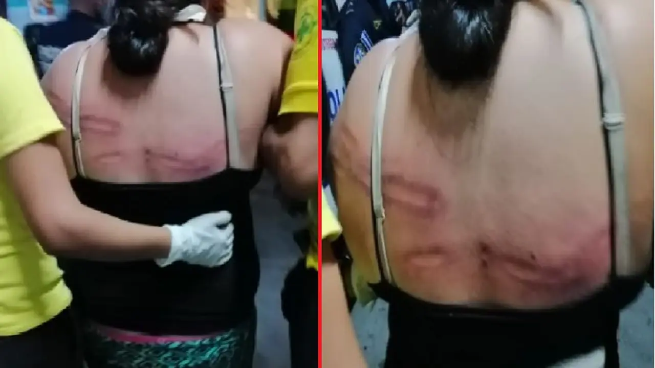 Mujer de 29 a&ntilde;os vapuleada