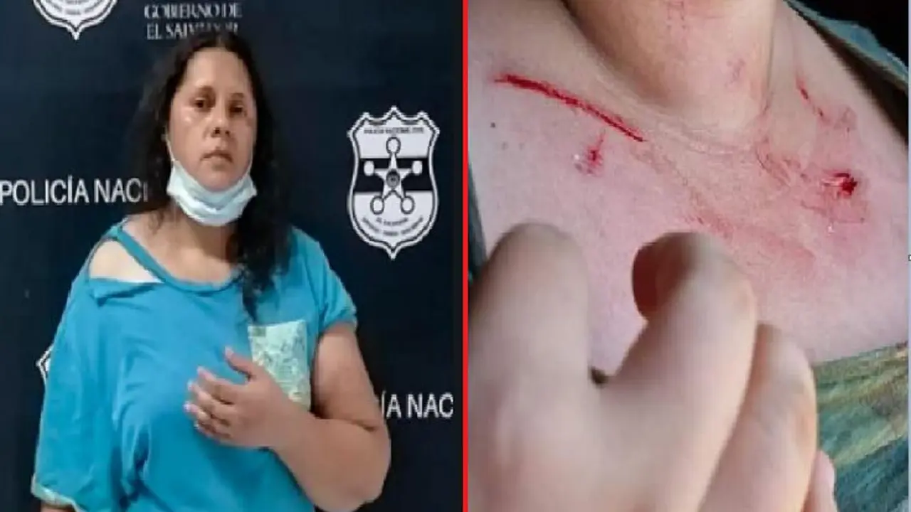 Agredi&oacute; con cuchillo a una joven de 21 a&ntilde;os