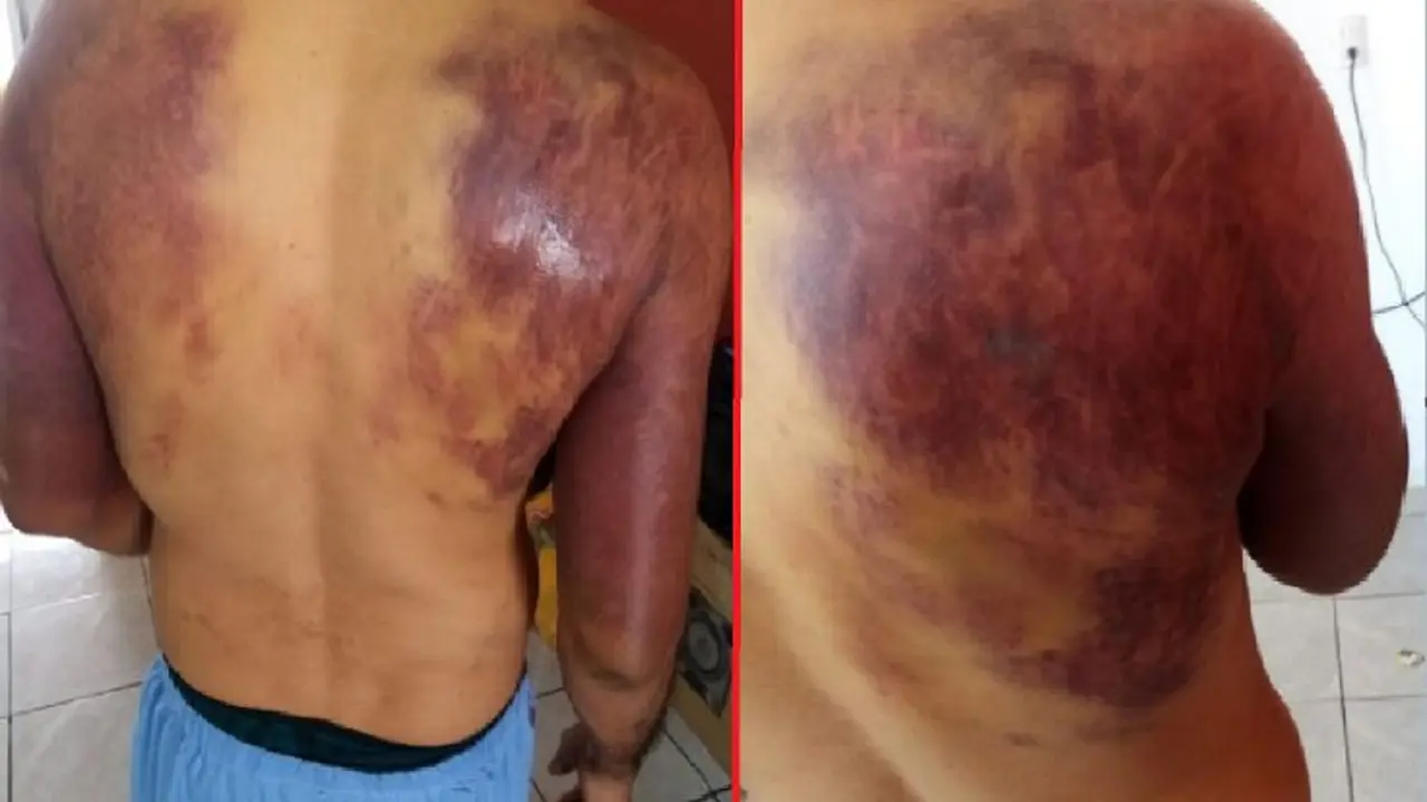 Trabajador recibe golpiza