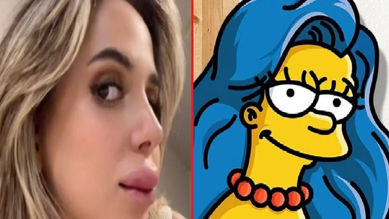 Tiktoker se opera los labios