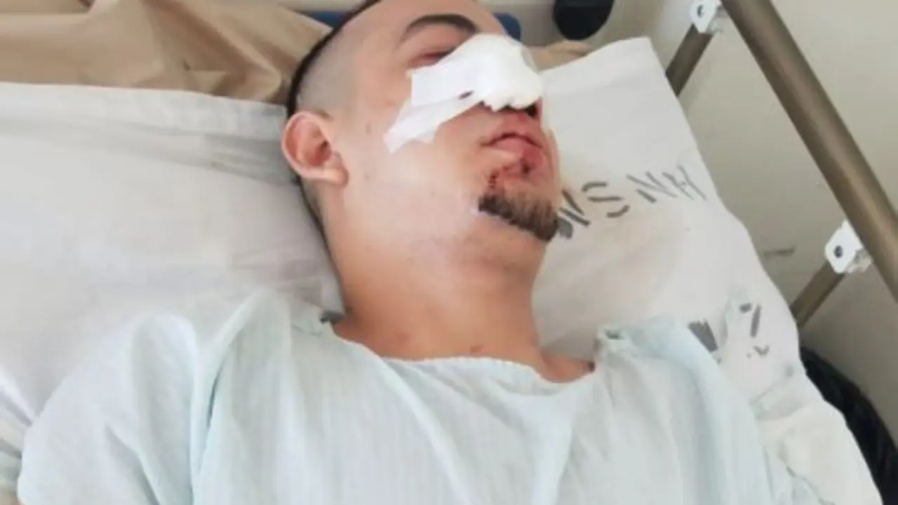 Pandillero en cirug&iacute;a