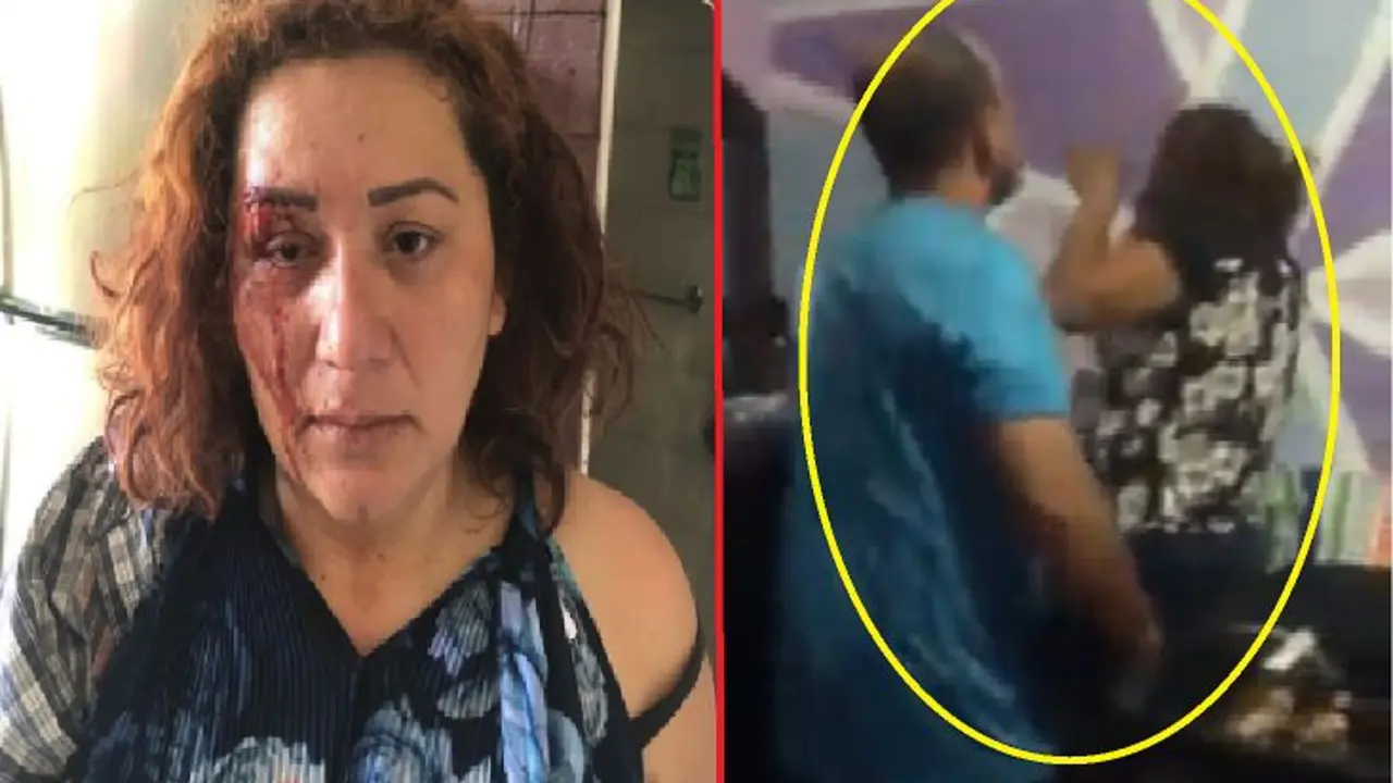 Mujer golpeada en Mejicanos