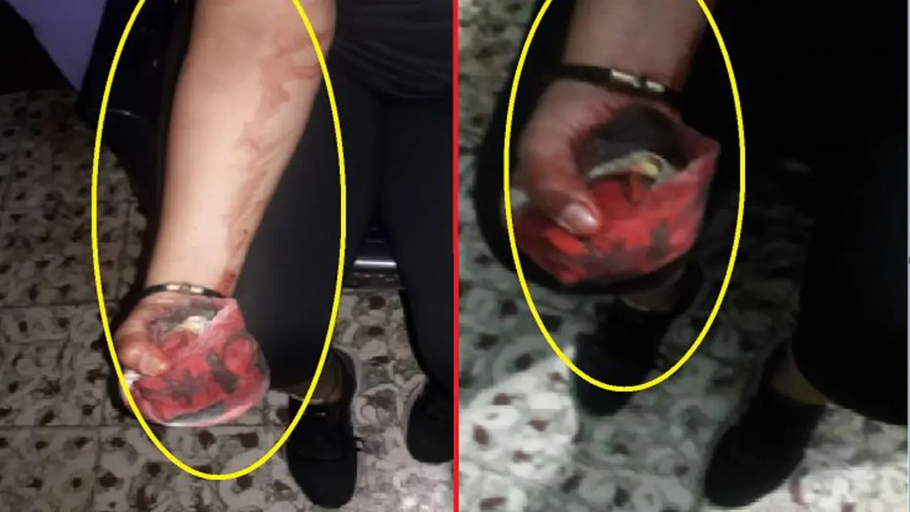 Golpeada con envase de cerveza