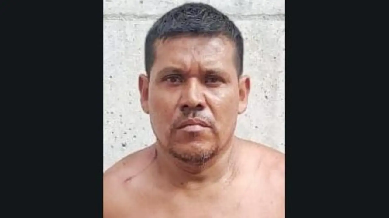 Le cort&oacute; la mano con machete