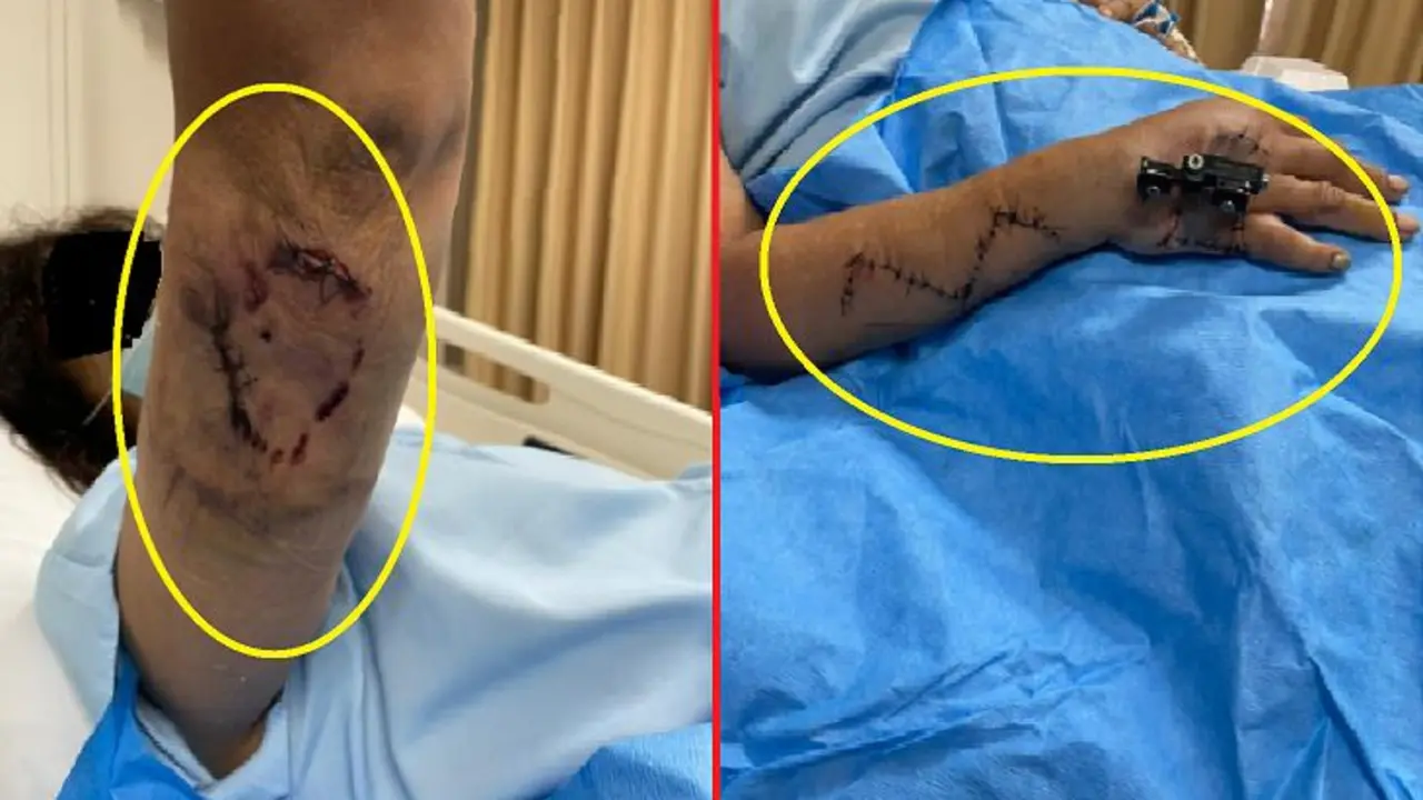 Mujer de 71 a&ntilde;os