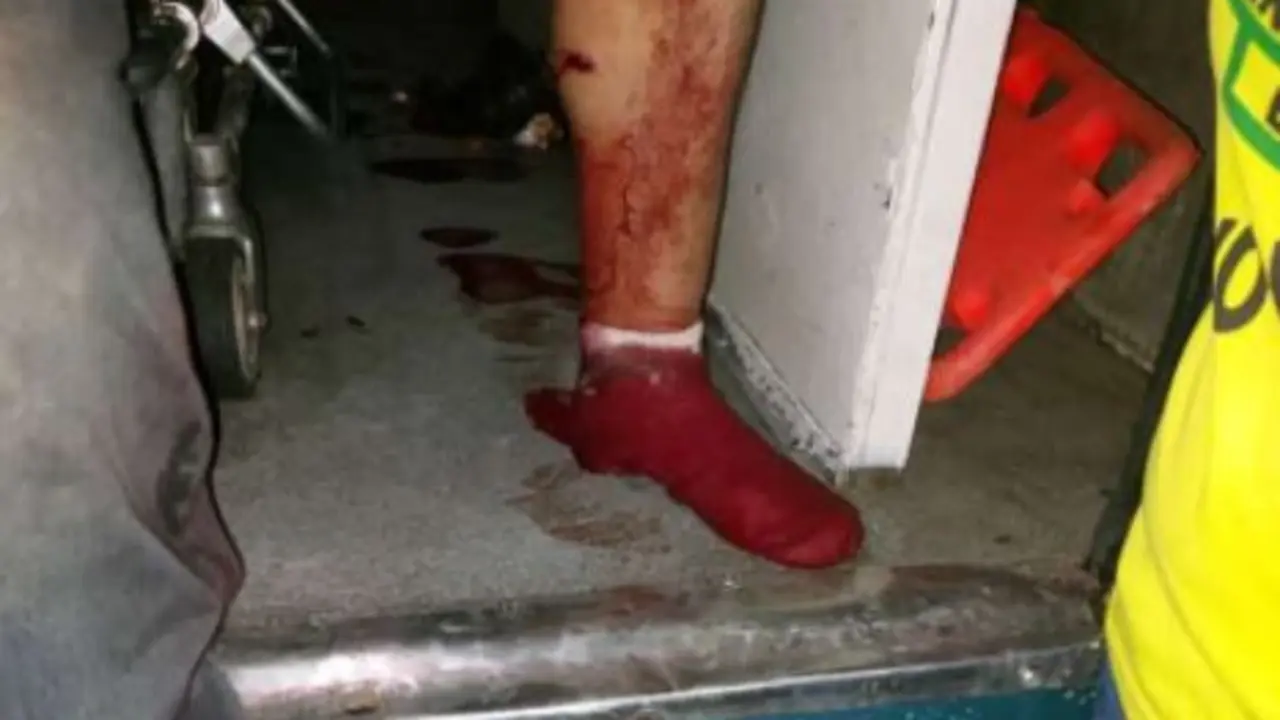 Baleado en pierna izquierda