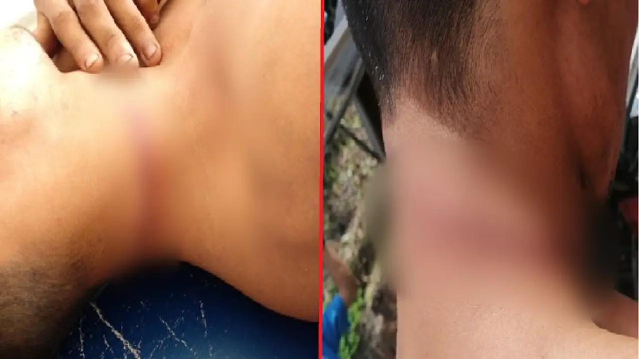 Se pretend&iacute;a ahorcar