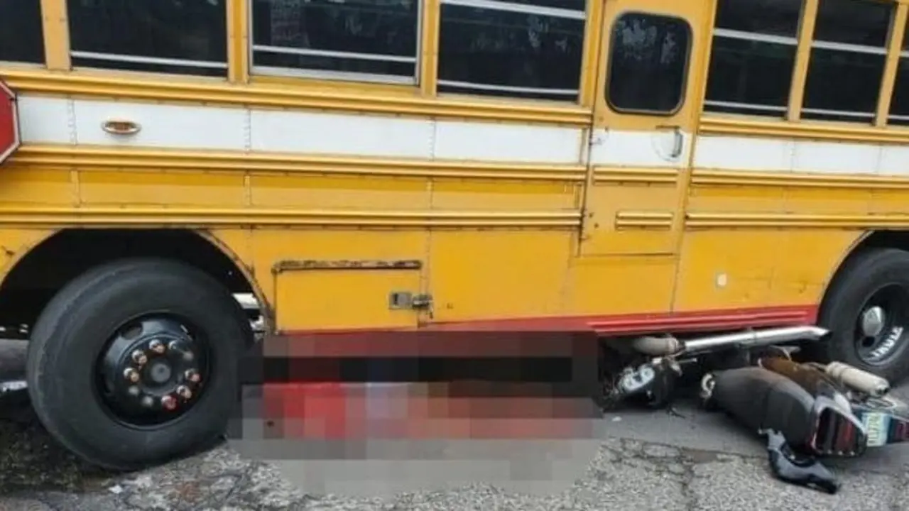 Atropellada en la Don Bosco