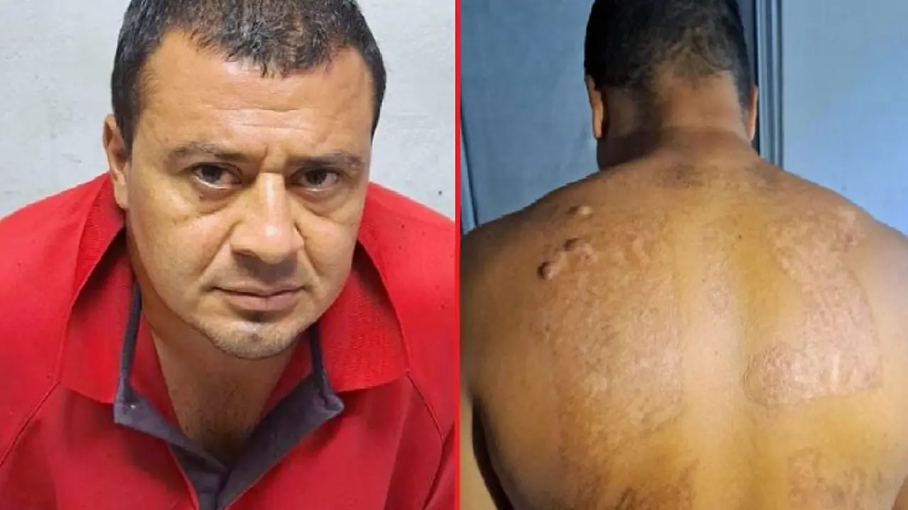 Supuesto pandillero intent&oacute; borrarse tatuajes