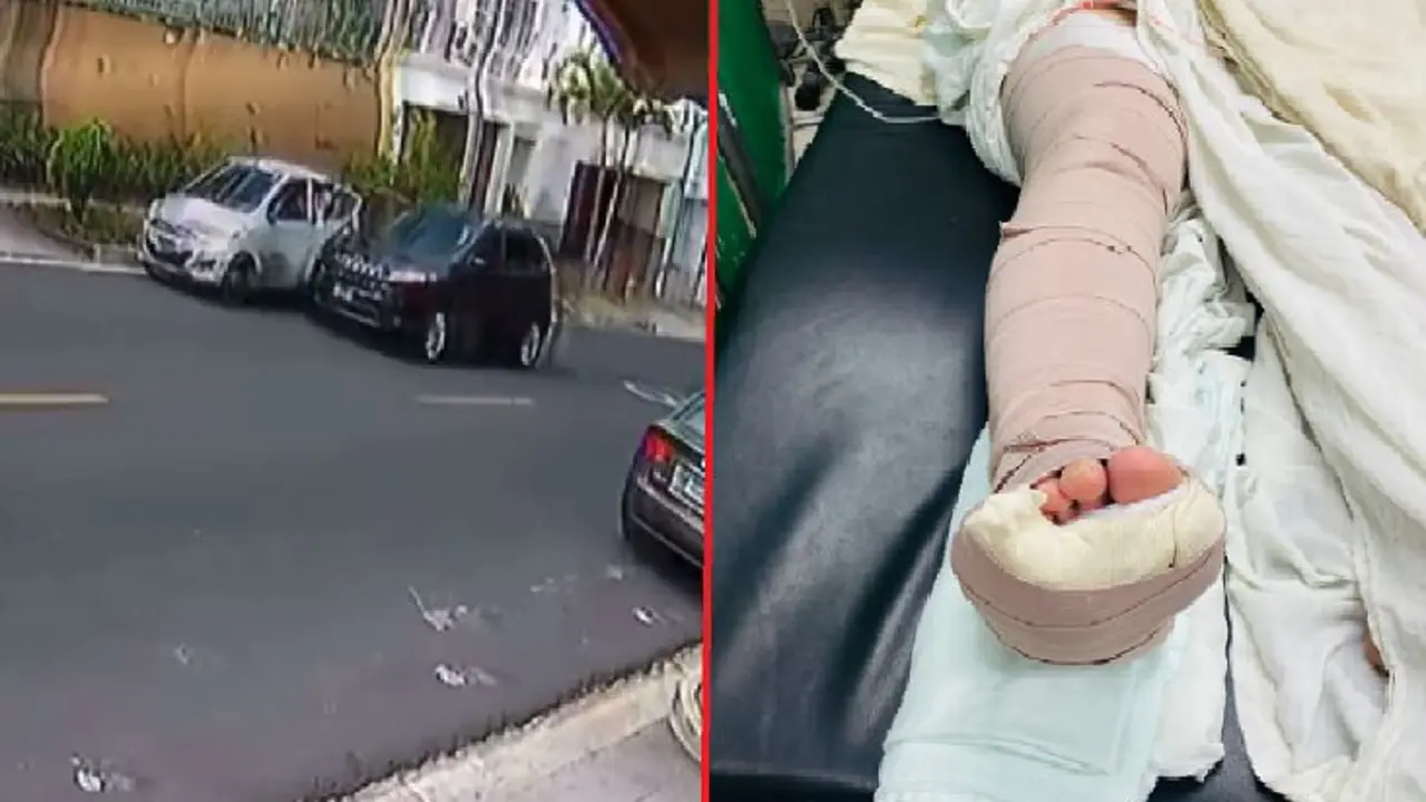 Quebradura en pierna derecha