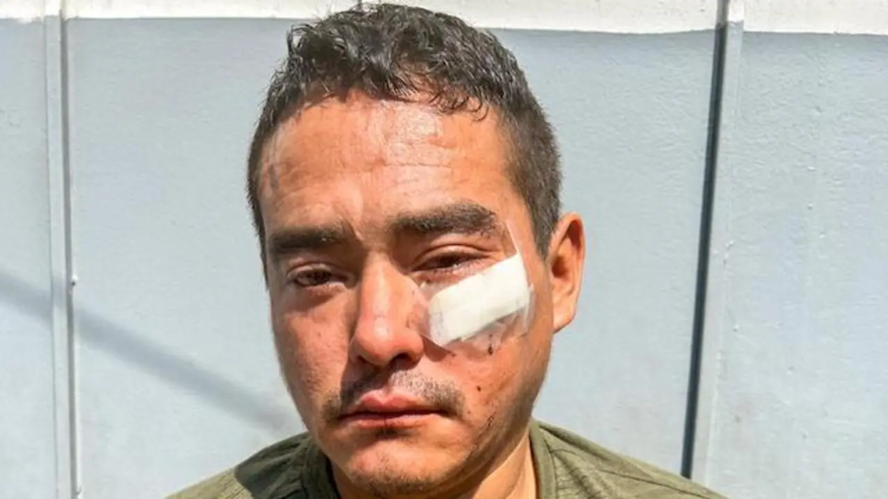 José Antonio Cañada Alas, intento de homicidio