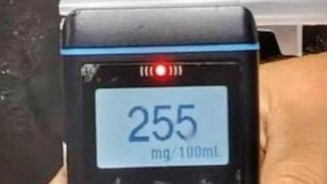 Mario Antonio Hernández Navas, 29 años de edad, conducción peligrosa, 255 grados 2