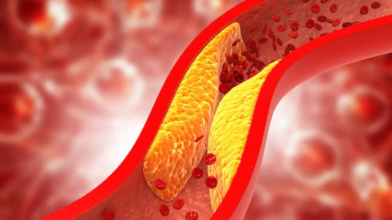 Colesterol en la sangre