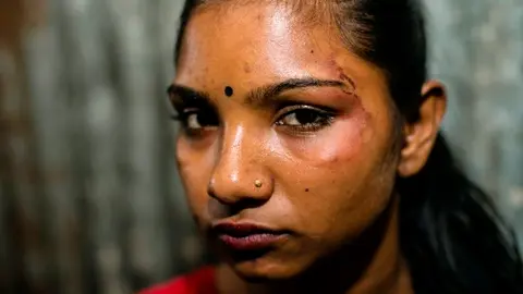 Las agresiones físicas son un caso común en Kandapara.