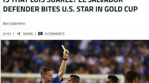 Goal compara la acción con lo ocurrido con Luis Suárez en el Mundial Brasil 2014.