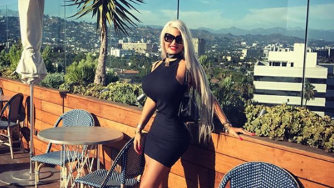 Recientemente se realizó una cirugía para extirparse cuatro costillas y asegurar así su torneada figura.