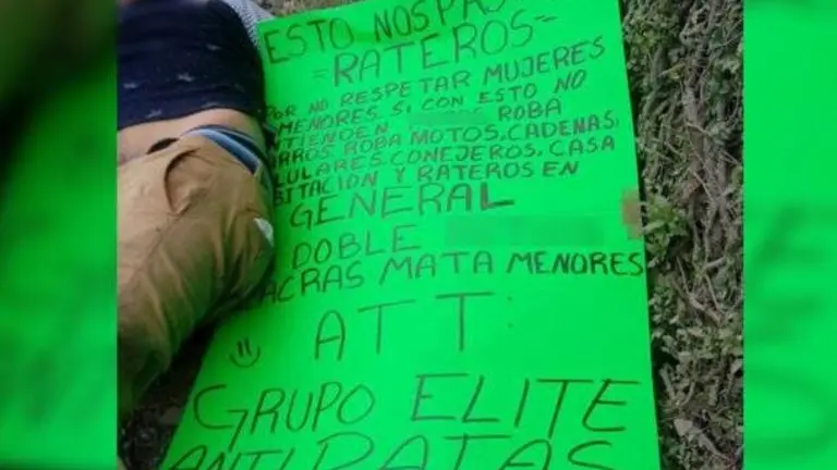 Amputan manos
